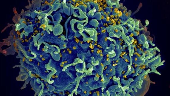HIV infecting a human cell